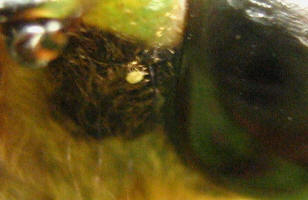 Close view of the side of the cicada's head. A dense patch of dark bristles covers the cheek, with the smooth green-black surface of the compound eye to the right. The small pale yellow animal sits among the bristles.