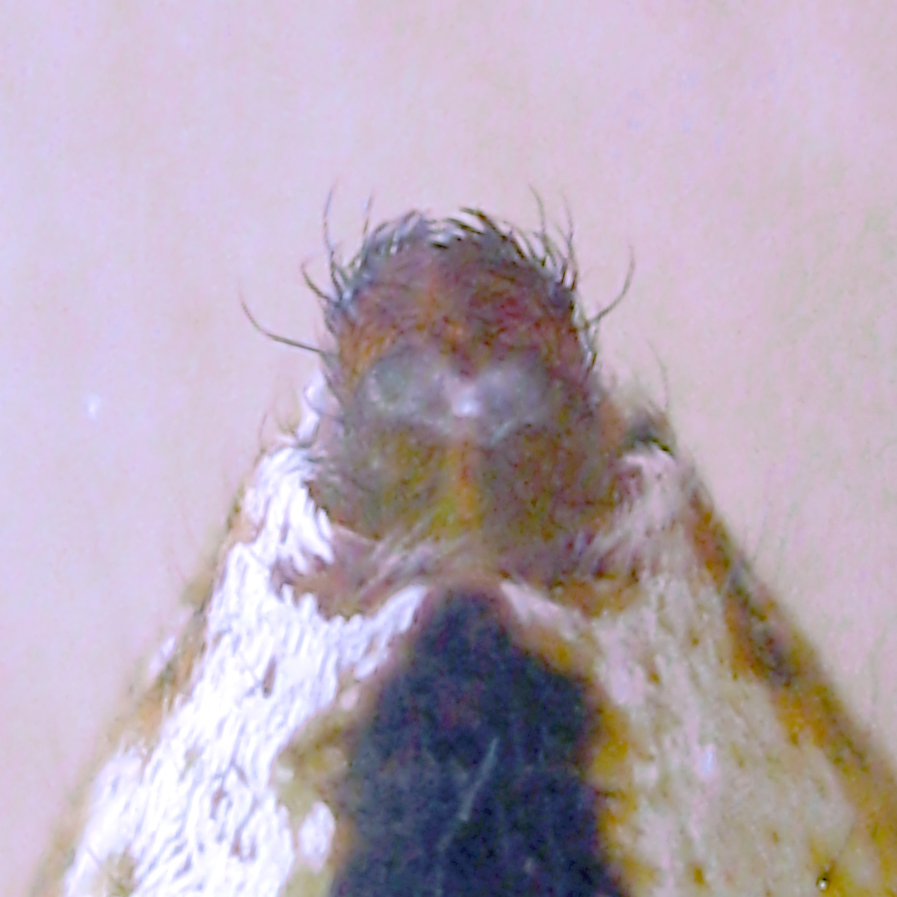 Ventral View of ♀ Spinnerates