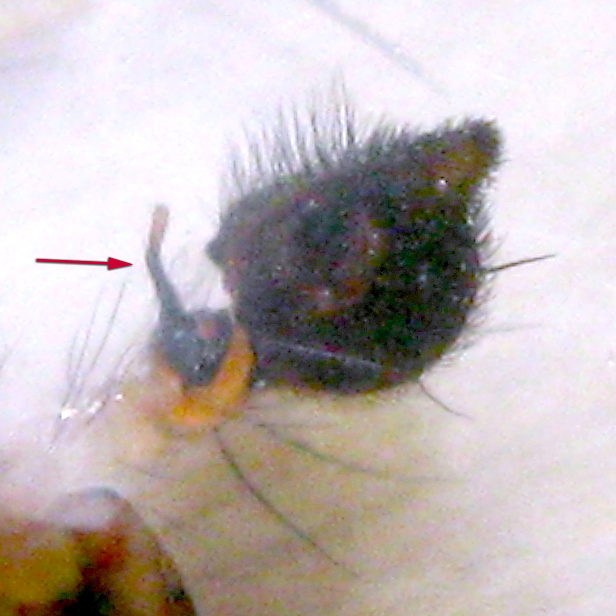 Ventral View of ♂ Pedipalp