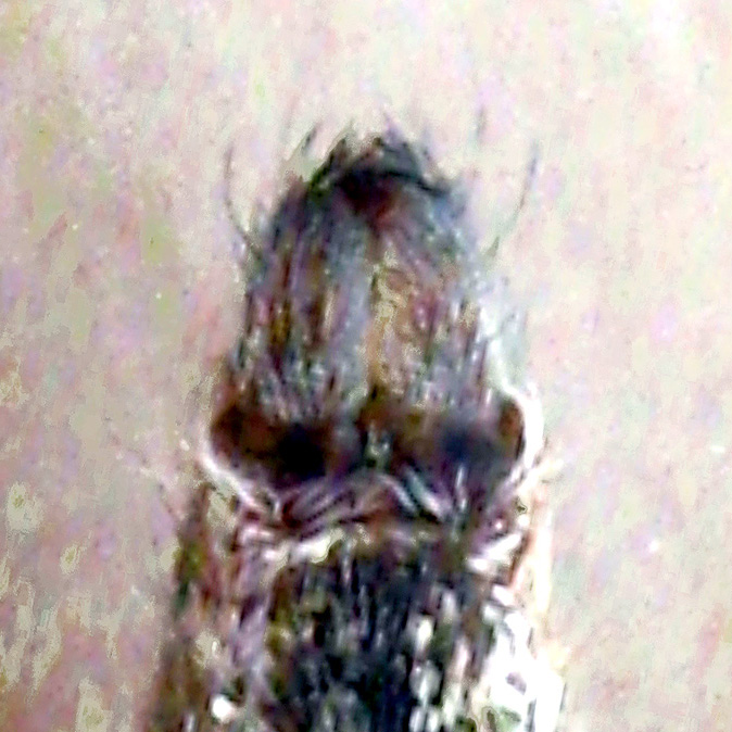 Ventral View of  ♂ Spinnerates